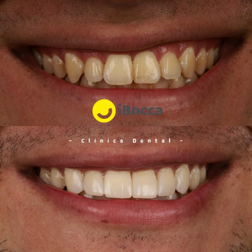 smile-design