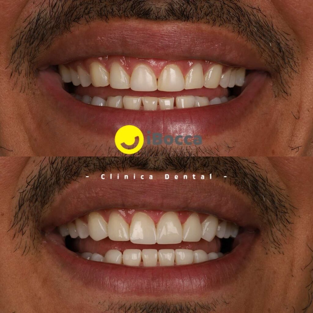 smile-design-colombia